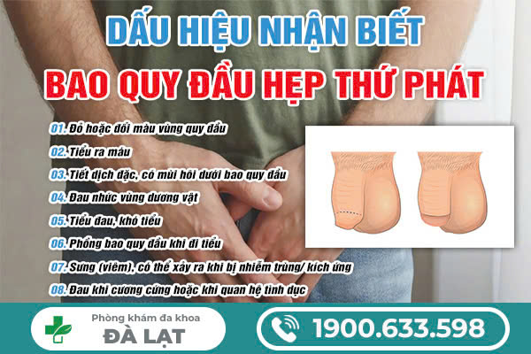 Hình ảnh minh họa